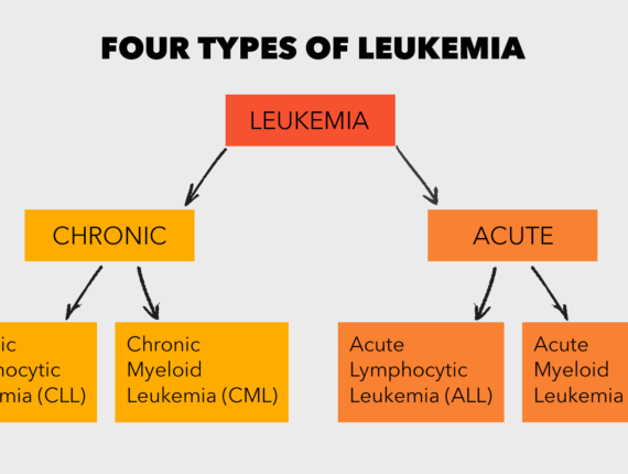 Types of Leukemia — Symptoms, Causes & Treatment - Healthy Time Mag